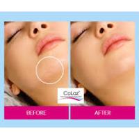CoLaz Advanced Aesthetics Clinic - Southall image 3